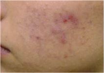 Before
